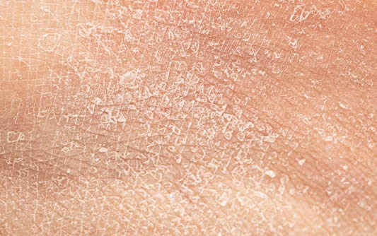 Dull & Rough Skin